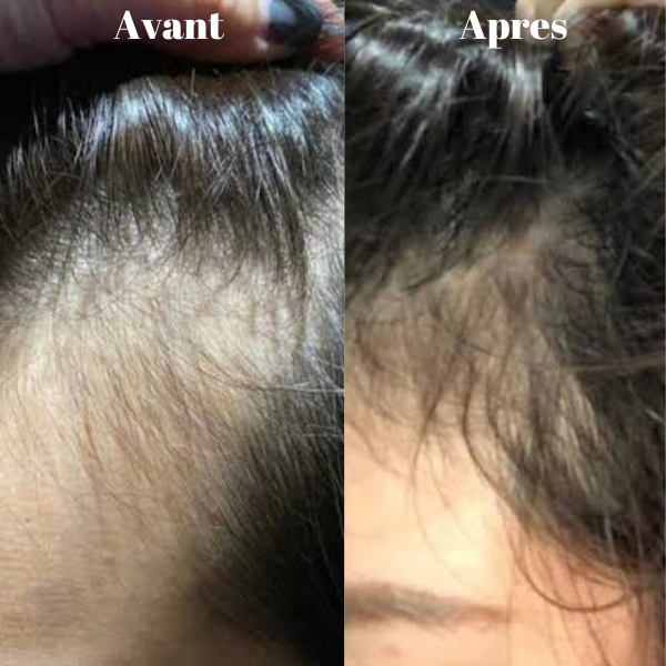 Masque Capillaire flore
